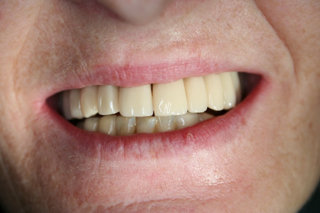 Bild